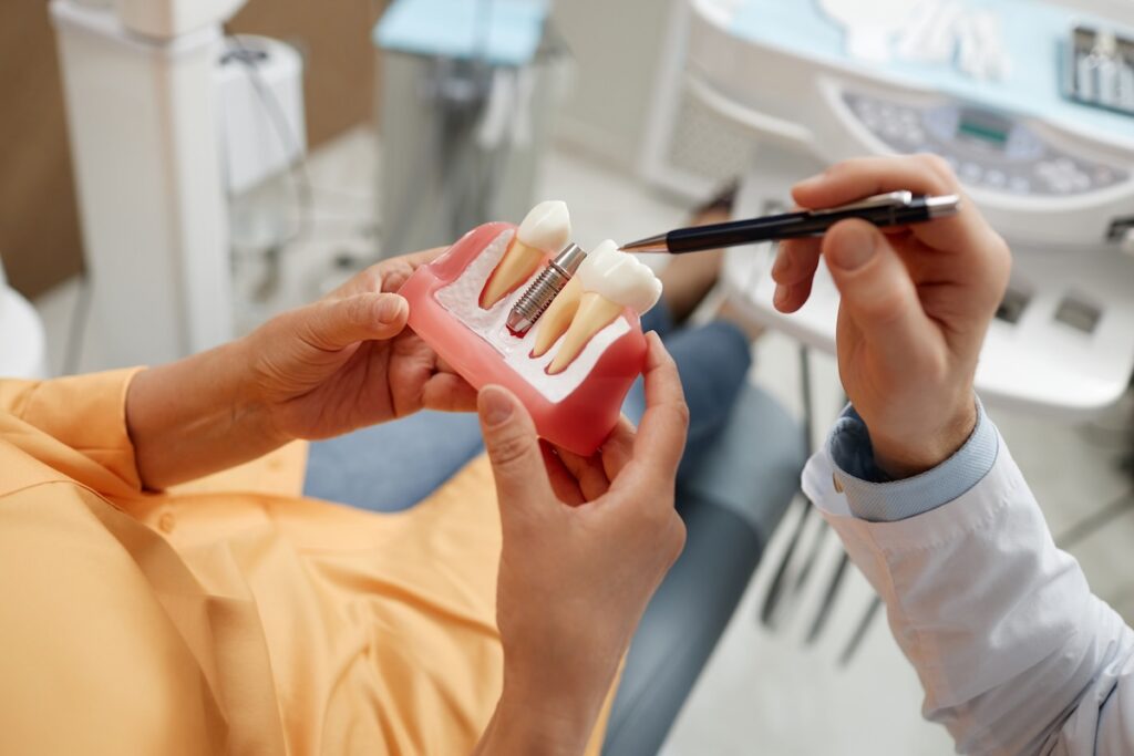 The Comfort Dentist | Dental Implants